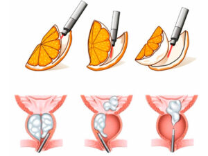 Pedro Heniruqe Moreira Urologista