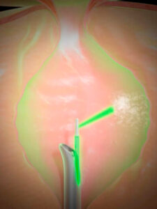 Pedro Heniruqe Moreira Urologista